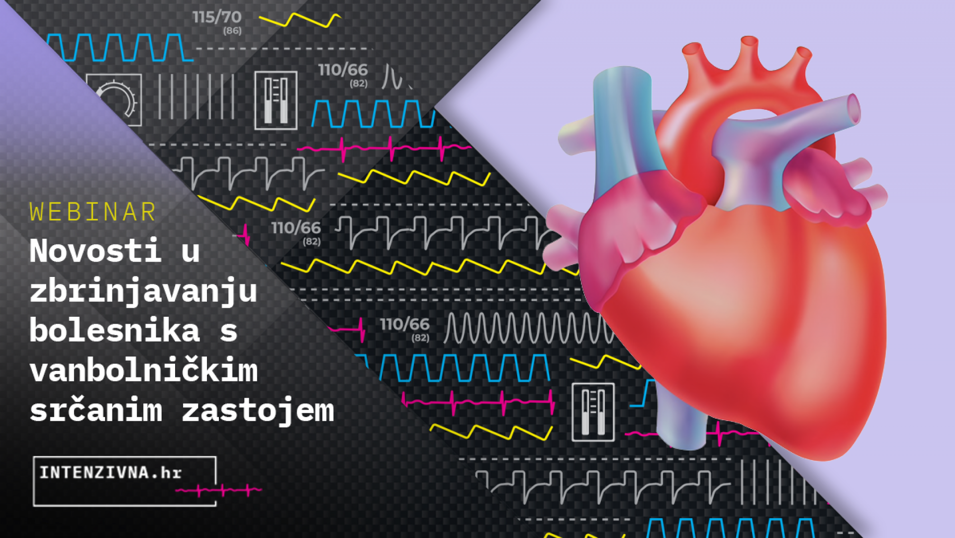 Novosti u zbrinjavanju bolesnika s vanbolničkim srčanim zastojem